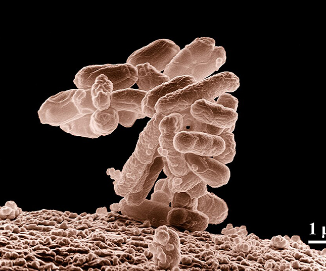 Escherichia coli Escherichia coli